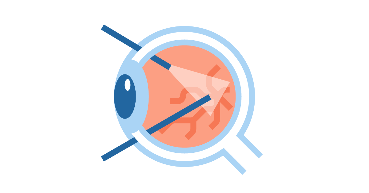 Vitreoretinal surgery icon